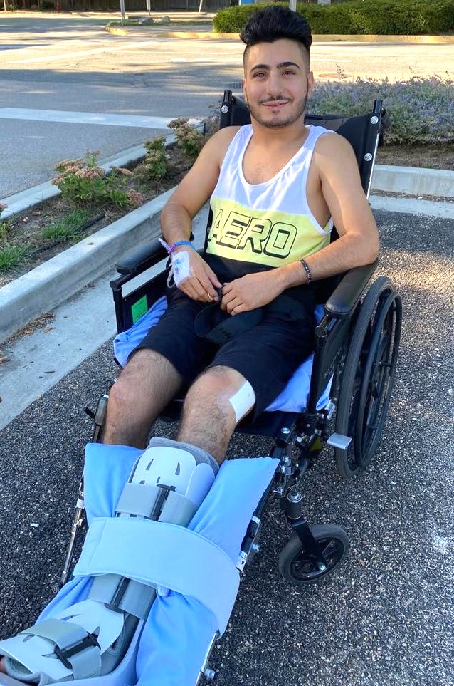 Ebrahim in a wheelchair with his leg in a cast at BCCH