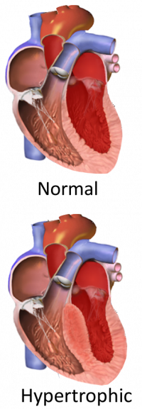 HCM