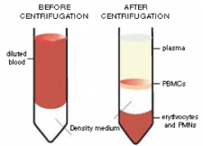 Gradient centrifugation