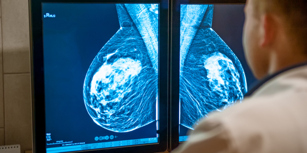 Technician looking at image of breast tissue